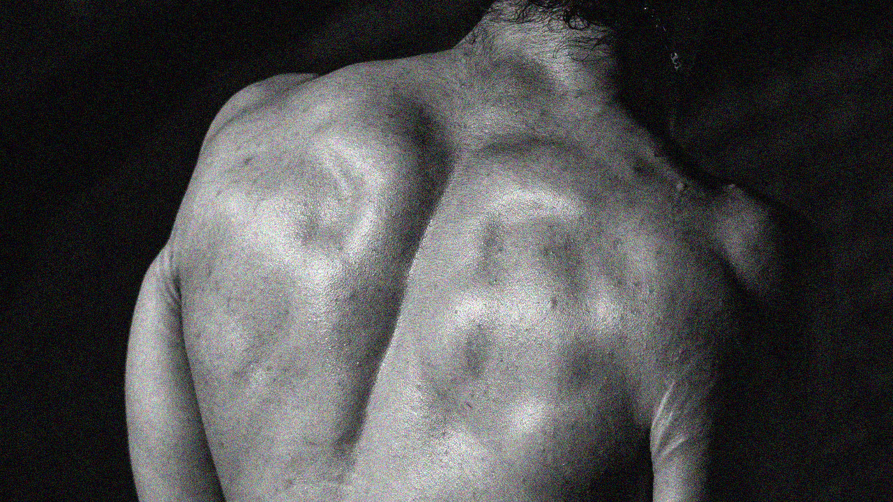 Black and white close-up of a person's back with visible skin texture.